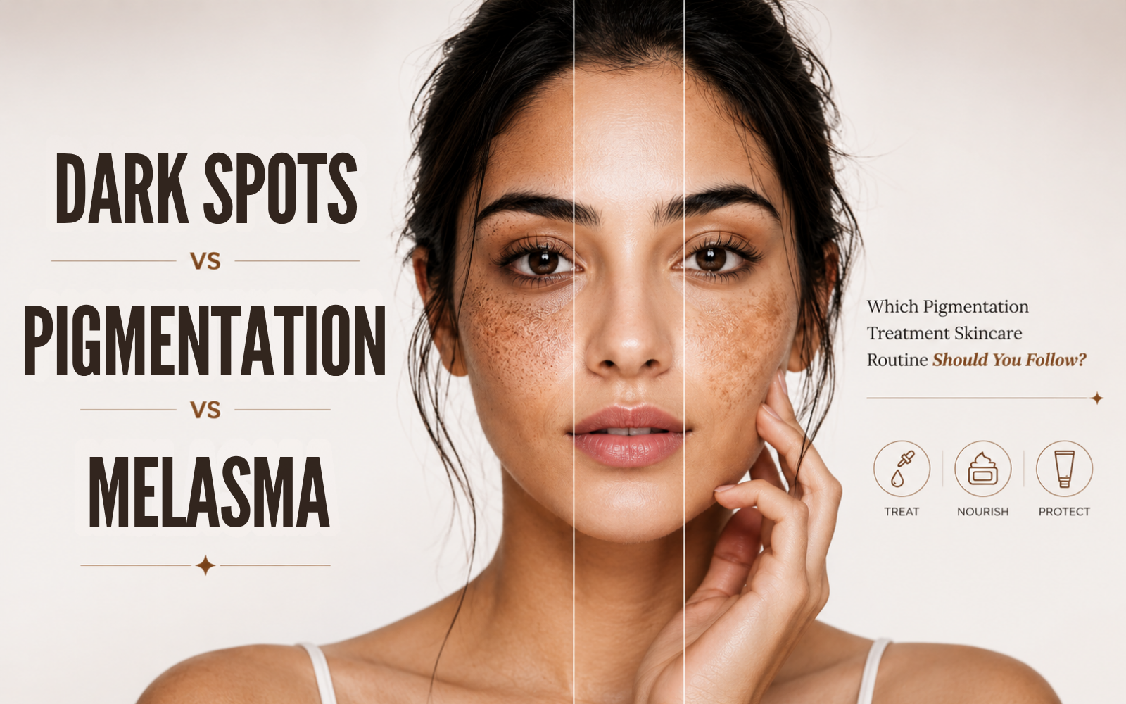 Dark Spots vs Pigmentation vs Melasma: Which Pigmentation Treatment Skincare Routine Should You Follow?